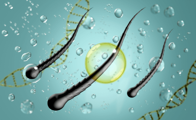 Plaukų priežiūra po plaukų transplantacijos